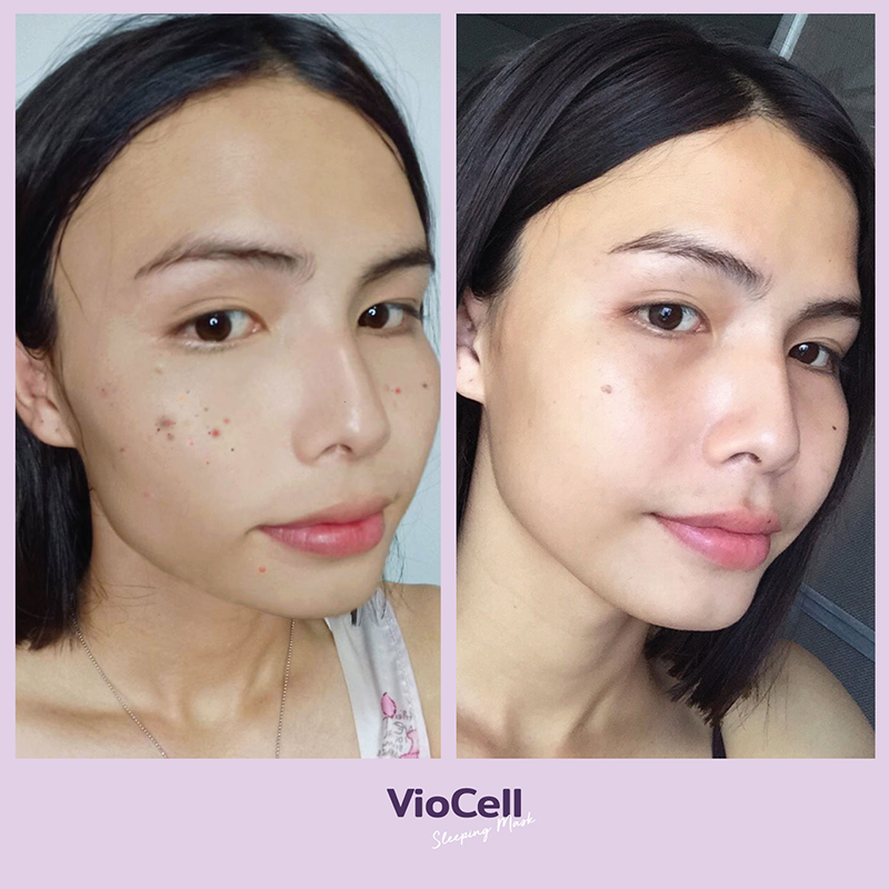 Toon-VioCell-Before-After-Sep2021